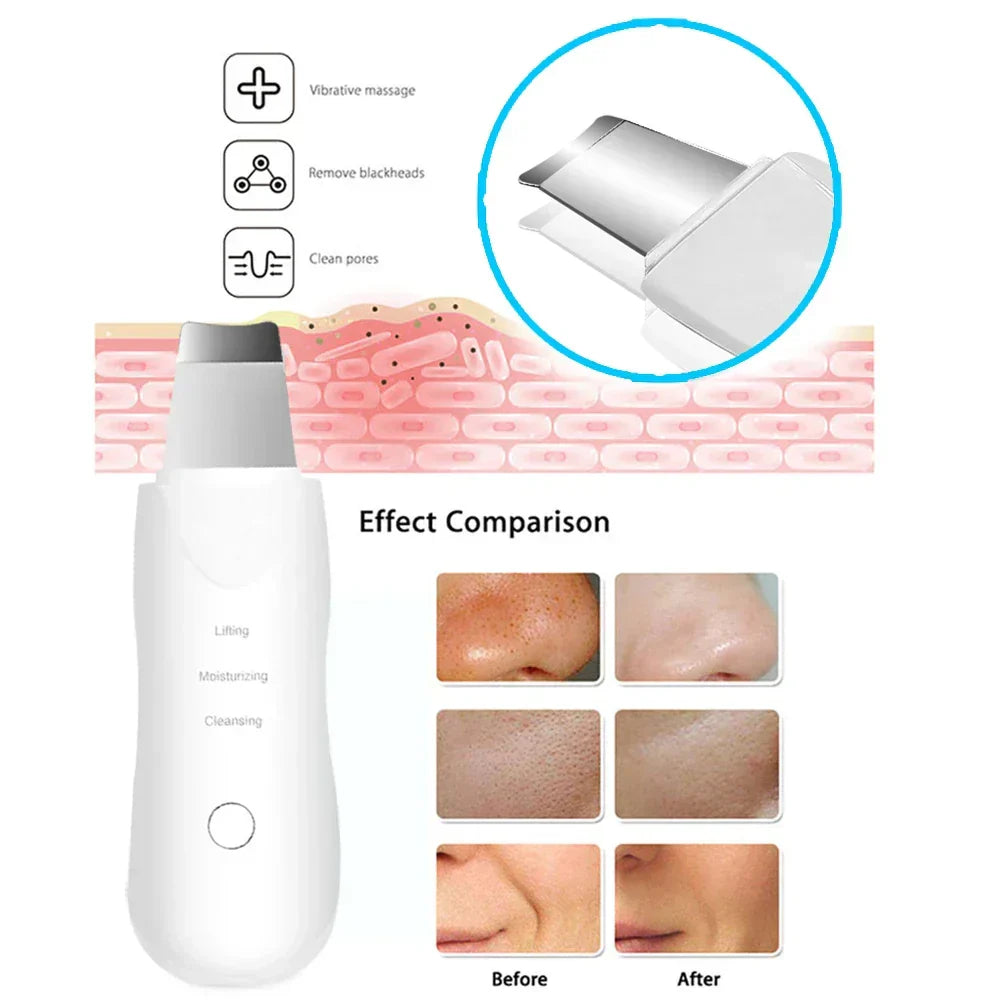 Vibration Face Skin Scrubber
